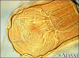 Hookworm - close-up of the organism Hookworm - close-up of the organism
