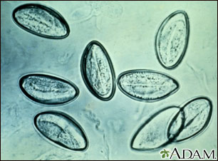Pinworm eggs Pinworm eggs