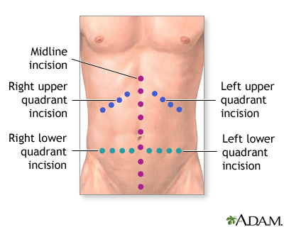 Procedure Procedure