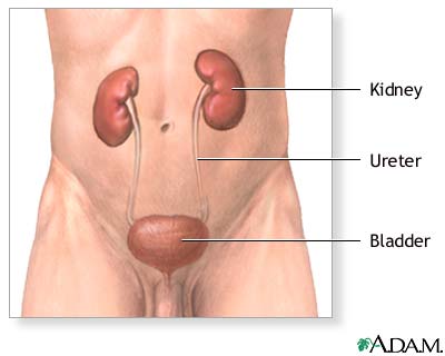 Kidney removal (nephrectomy) - series Kidney removal (nephrectomy) - series