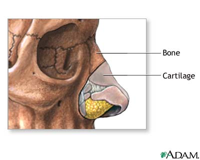 Nose surgery - series Nose surgery - series