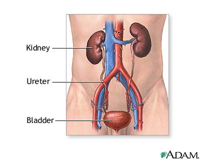 Kidney transplant - series Kidney transplant - series