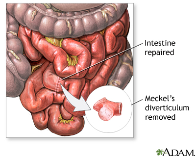 Procedure Procedure
