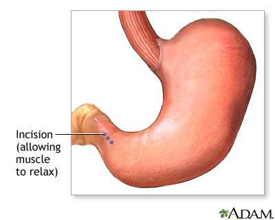 Procedure Procedure