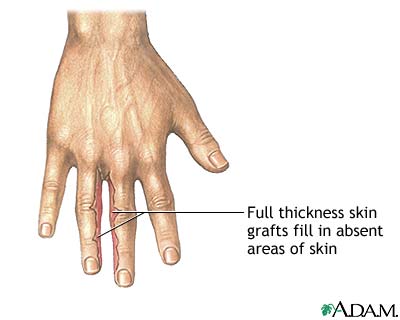 Procedure Procedure