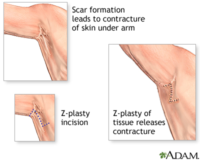 Procedure, Part 1 Procedure, Part 1