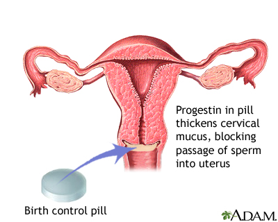 Progestin in pill Progestin in pill