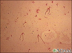Yersinia enterocolitica organism Yersinia enterocolitica organism