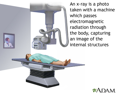 X-ray