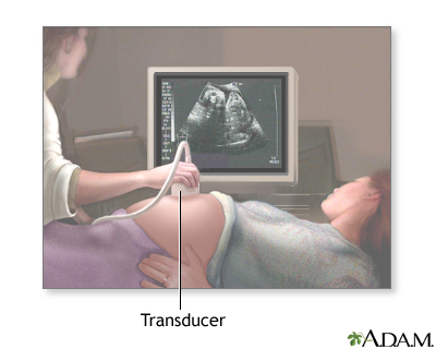 Ultrasound in pregnancy Ultrasound in pregnancy