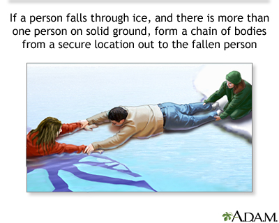 Drowning rescue on the ice, human chain Drowning rescue on the ice, human chain