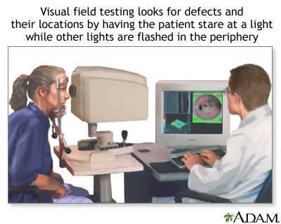 Visual field test Visual field test