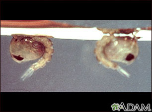 Mosquito, pupa Mosquito, pupa