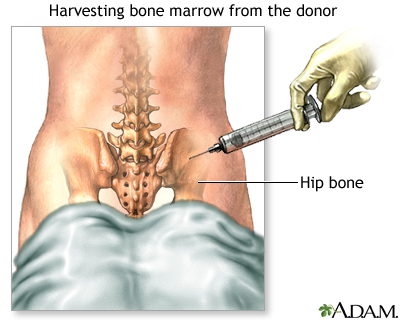 Procedure Procedure