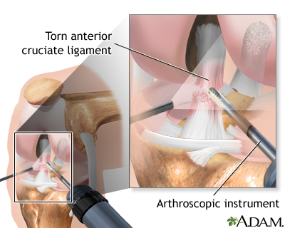 Procedure, part 2 Procedure, part 2