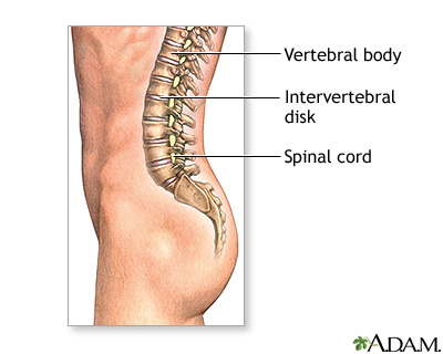 Spinal fusion - series - Normal anatomy Spinal fusion - series - Normal anatomy