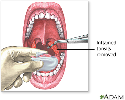 Procedure Procedure