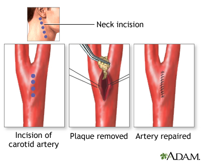 Procedure Procedure