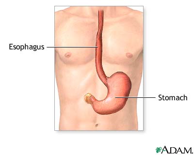 Gastrostomy tube placement - series Gastrostomy tube placement - series