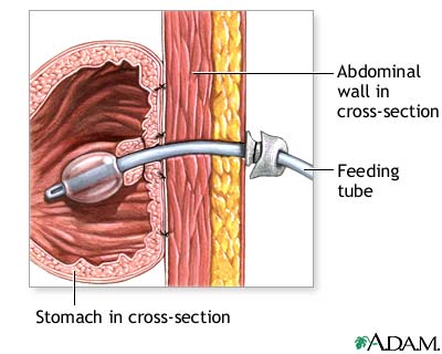 Procedure, part 1 Procedure, part 1