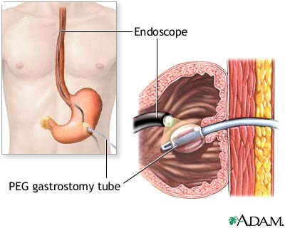 Procedure, part 2 Procedure, part 2