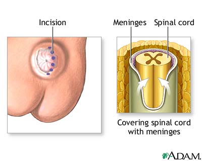 Procedure Procedure