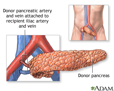 Procedure, part 2 Procedure, part 2