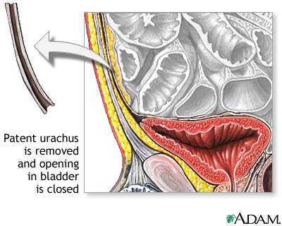 Procedure Procedure
