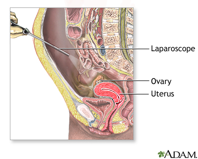 Procedure Procedure