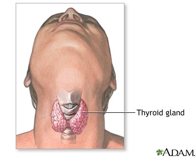 Thyroidectomy - Series Thyroidectomy - Series