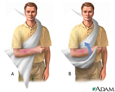 Creating a sling - series Creating a sling - series