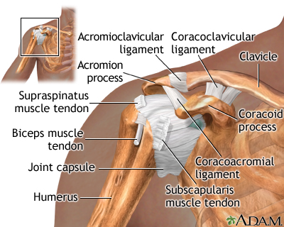 Shoulder separation - Series Shoulder separation - Series