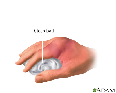 Hand splint - series Hand splint - series