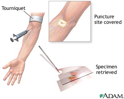 Procedure Procedure