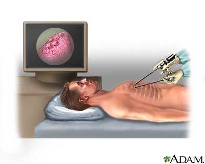 Procedure Procedure