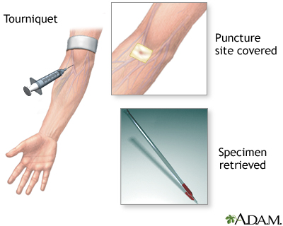Procedure Procedure