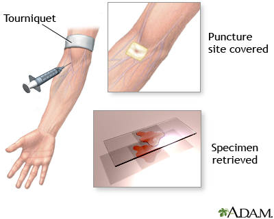 Procedure Procedure