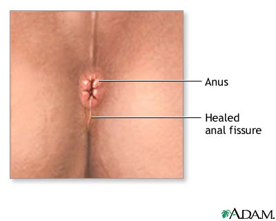 Procedure Procedure