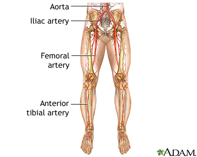 Arterial bypass leg - series - Normal anatomy Arterial bypass leg - series - Normal anatomy