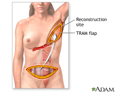 Procedure, part 1 Procedure, part 1