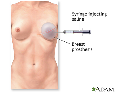 Procedure, part 2 Procedure, part 2