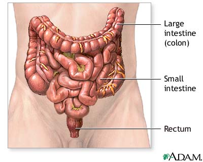 Colon cancer - series Colon cancer - series