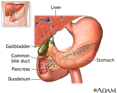 Endoscopic retrograde cholangio pancreatography (ERCP) - series Endoscopic retrograde cholangio pancreatography (ERCP) - series