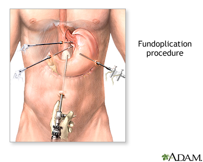 Procedure, part 1 Procedure, part 1