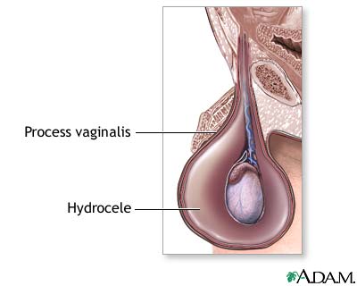 Indications Indications