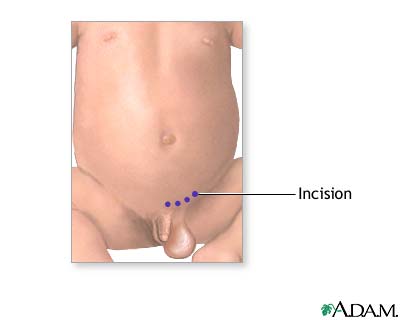 Procedure Procedure