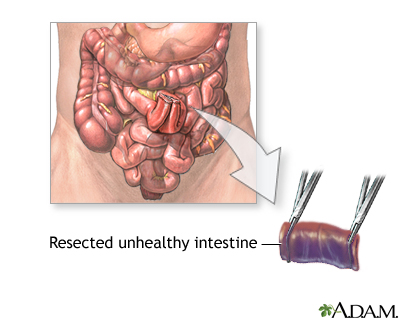 Procedure Procedure