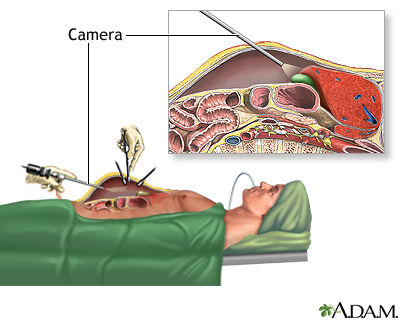 Procedure, part 1 Procedure, part 1