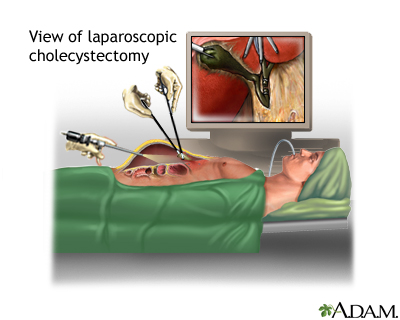 Procedure, part 2 Procedure, part 2