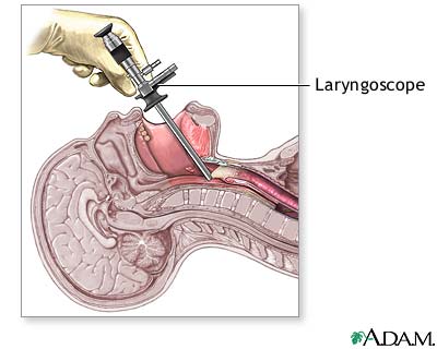 Procedure, part 1 Procedure, part 1